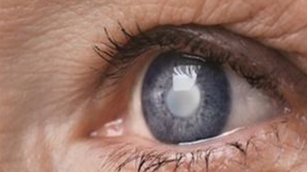 SESA se adhiere a la conmemoración del Día Mundial del Glaucoma